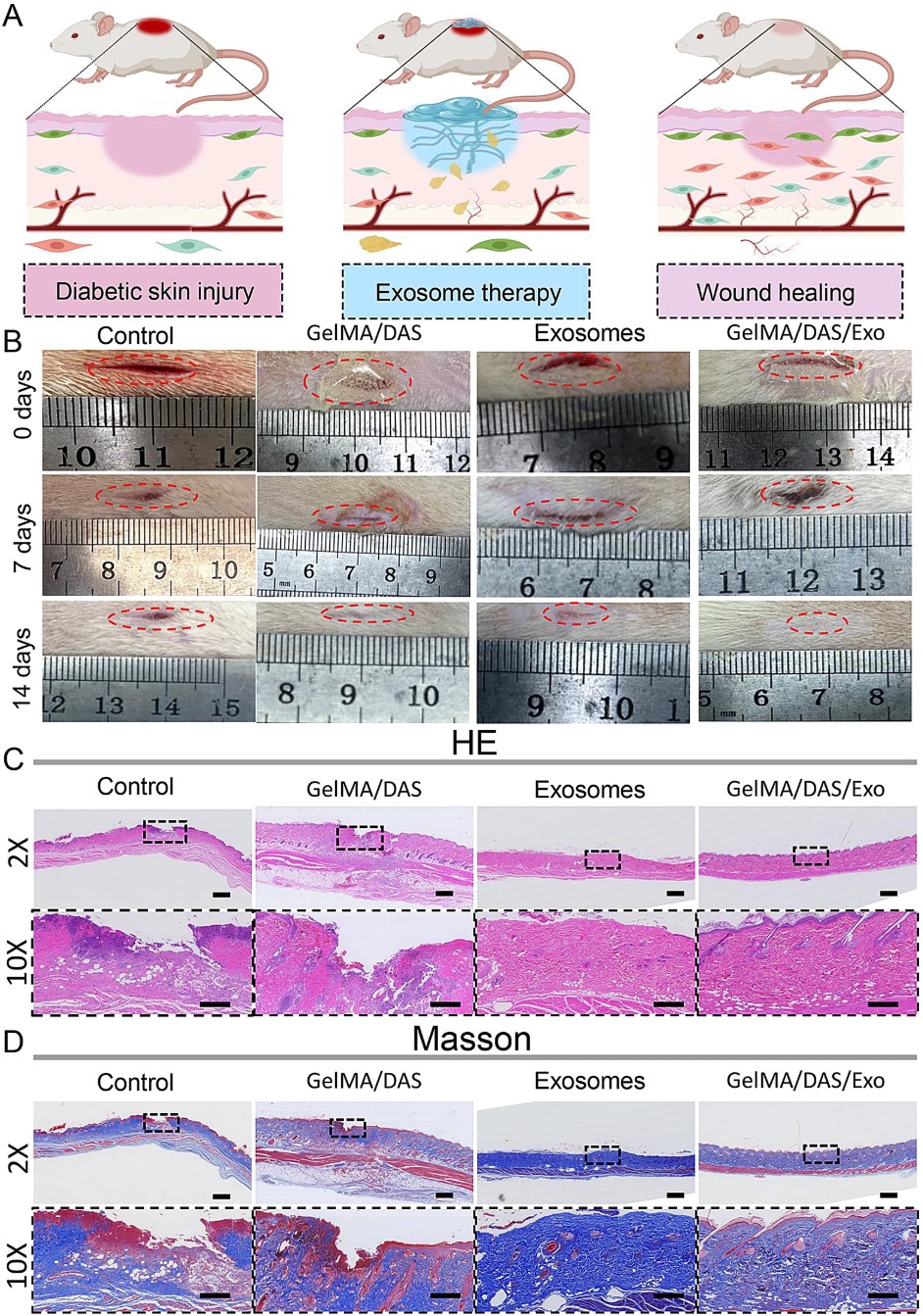 GelMA/DAS hydrogel with lemon exosomes enhances wound closure, re-epithelialization, and collagen deposition in diabetic rat skin injury model.